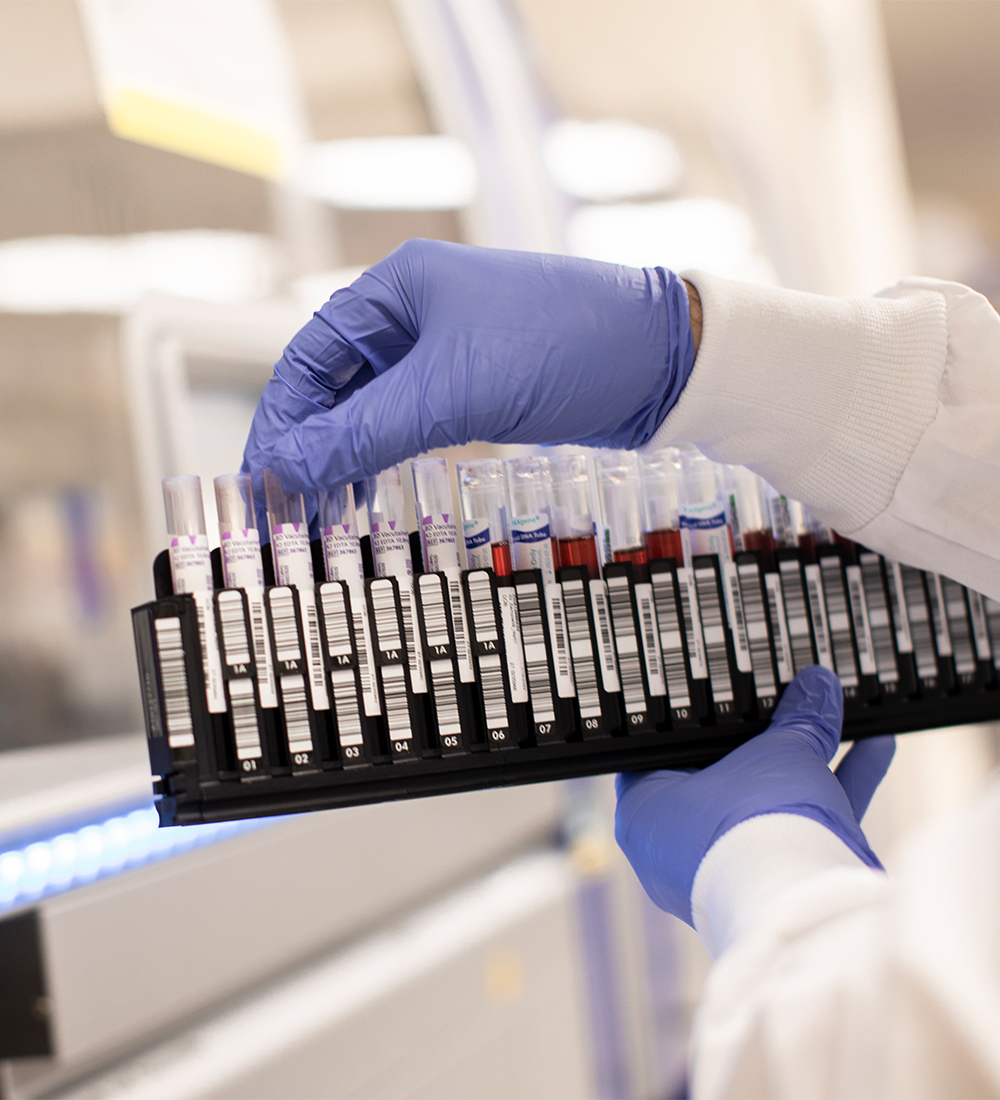 Personalis | Transforming the Active Management of Cancer