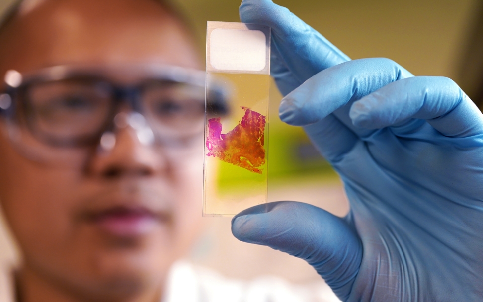 Personalis | Transforming the Active Management of Cancer